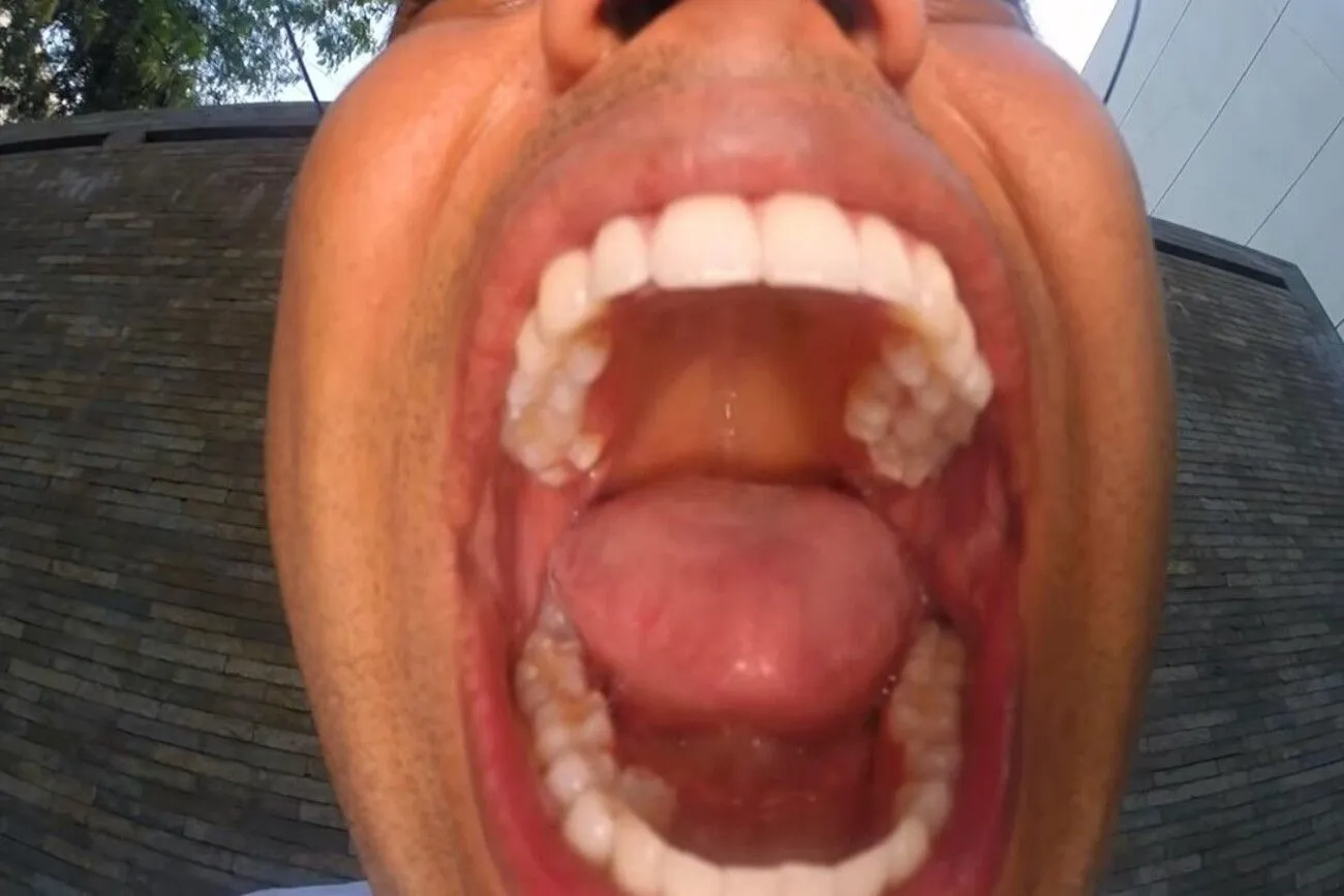 Most teeth in the mouth - Guinness World Records (1).jpg?format=webp